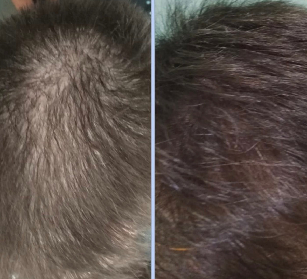 Botavie Hair serum