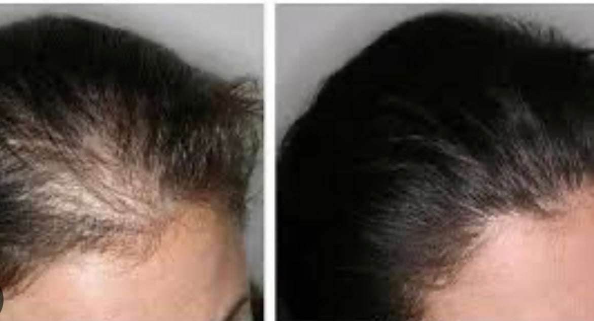 Botavie Hair serum