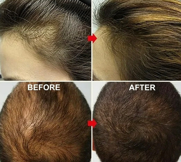 Botavie Hair serum