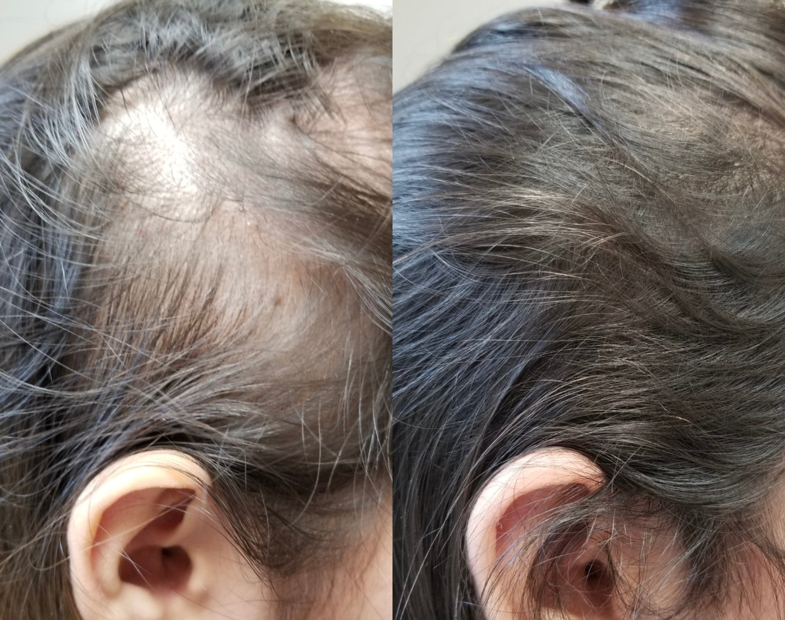 Botavie Hair serum