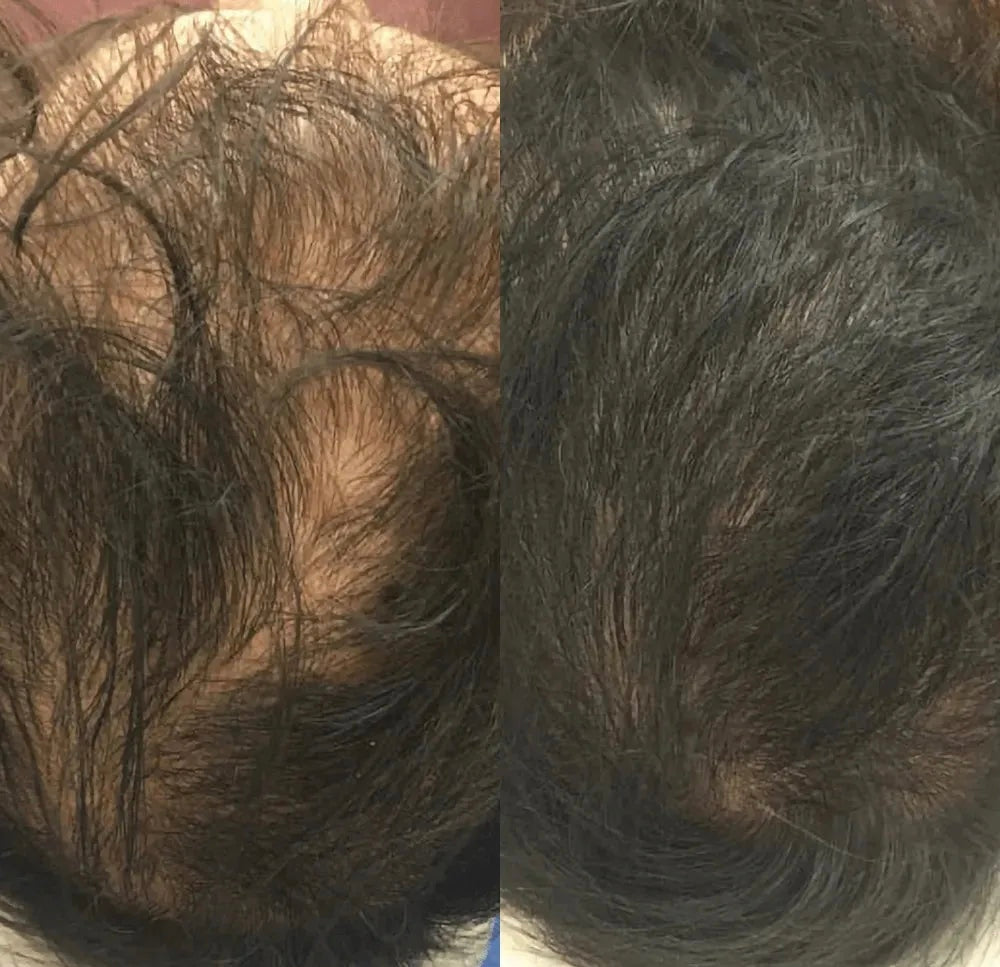 Botavie Hair serum